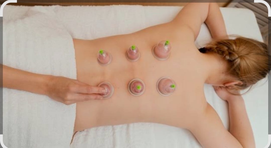 Schröpfkopfmassage am Rücken – Rustam Schmidt Arnsberg